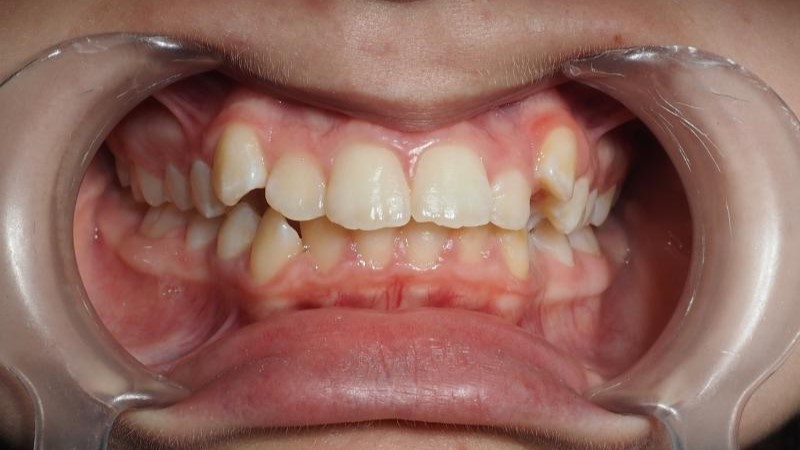 Julia przed leczeniem