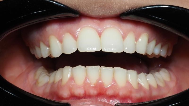 Nikola przed leczeniem